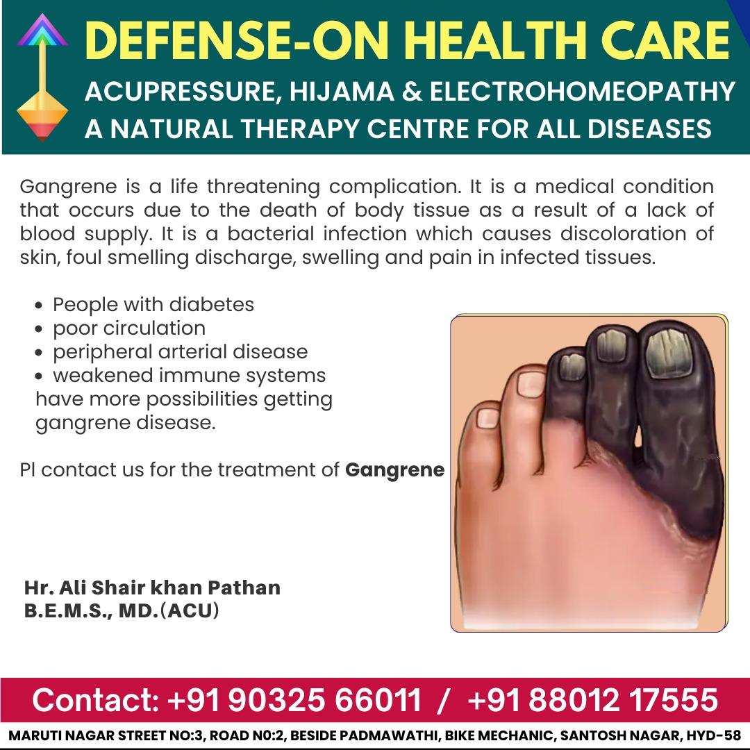 Gangrene Treatment by Dr. Ali Shair khan Pathan - Hyderabad